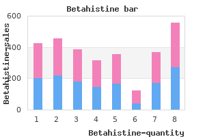 generic betahistine 16 mg