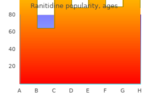 order 300mg ranitidine mastercard