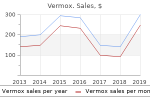 order 100 mg vermox with visa